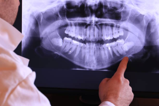 Best Broken Tooth Emergency  in Iona, ID